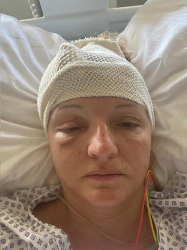 2. den po operaci mozkového aneurysma